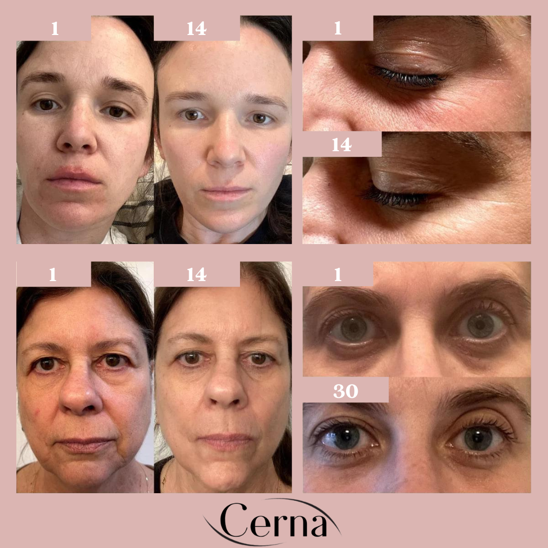 Cerna Skin™ Pro - The pencil for dark circles